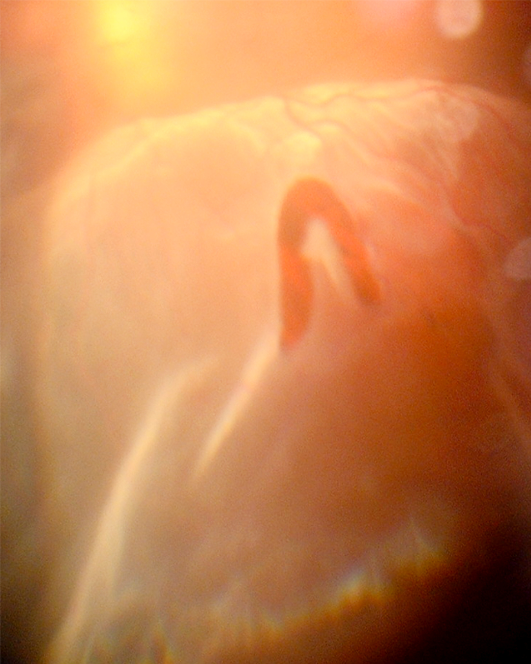 Image Bank
